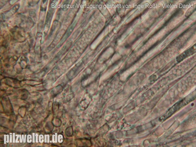 Schwarzweißes Filzbecherchen, Tapesia lividofusca